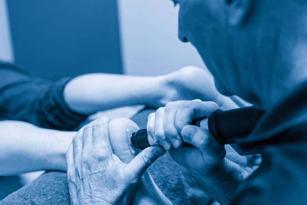 Man voert fysiotherapie uit met echografie apparaat voor knieklachten. shockwavetherapie